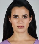after fillers front view female patient case 5037