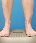 after liposuction lower front leg view female patient case 1577